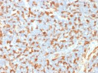 Formalin-fixed, paraffin-embedded Human Lymph Node stained with AIF1 / Iba1 Mouse Monoclonal Antibody (AIF1/1909).