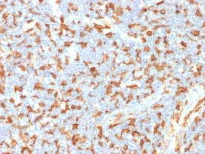 Formalin-fixed, paraffin-embedded Human Lymph Node stained with AIF1 / Iba1 Mouse Monoclonal Antibody (AIF1/1909).