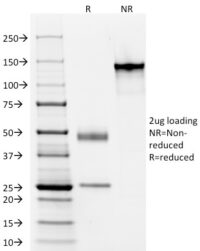 SDS-PAGE Analysis Purified Elastin Mouse Monoclonal Antibody (ELN/1981) Confirmation of Integrity and Purity of Antibody.