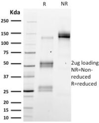 SDS-PAGE Analysis Purified Emerin Mouse Monoclonal Antibody (EMD/2167).Confirmation of Integrity and Purity of Antibody.