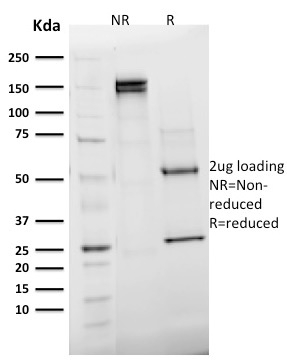 SDS-PAGE Analysis Purified Emerin Mouse Monoclonal Antibody (EMD/2168).Confirmation of Integrity and Purity of Antibody