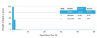 Analysis of Protein Array containing more than 19,000 full-length human proteins using HER-2 Mouse Monoclonal Antibody (ERBB2/2453). Z- and S- Score: The Z-score represents the strength of a signal that a monoclonal antibody (MAb) (in combination with a fluorescently-tagged anti-IgG secondary antibody) produces when binding to a particular protein on the HuProtTM array. Z-scores are described in units of standard deviations (SDs) above the mean value of all signals generated on that array. If targets on HuProtTM are arranged in descending order of the Z-score, the S-score is the difference (also in units of SDs) between the Z-score. S-score therefore represents the relative target specificity of a MAb to its intended target.  A MAb is considered to specific to its intended target, if the MAb has an S-score of at least 2.5. For example, if a MAb binds to protein X with a Z-score of 43 and to protein Y with a Z-score of 14, then the S-score for the binding of that MAb to protein X is equal to 29.