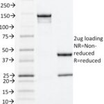 SDS-PAGE Analysis Purified Estrogen Receptor alpha Mouse Monoclonal Antibody (ESR1/1935).Confirmation of Integrity and Purity of Antibody.