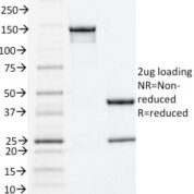 SDS-PAGE Analysis Purified Estrogen Receptor alpha Mouse Monoclonal Antibody (ESR1/1935).Confirmation of Integrity and Purity of Antibody.