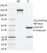 SDS-PAGE Analysis Purified Estrogen Receptor alpha Mouse Monoclonal Antibody (ESR1/1935).Confirmation of Integrity and Purity of Antibody.