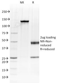 SDS-PAGE Analysis Purified Albumin Mouse Monoclonal Antibody (ALB/2144).Confirmation of Integrity and Purity of Antibody.