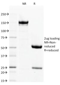 SDS-PAGE Analysis  Purified Filaggrin Mouse Monoclonal Antibody (FLG/1563).Confirmation of Integrity and Purity of Antibody.