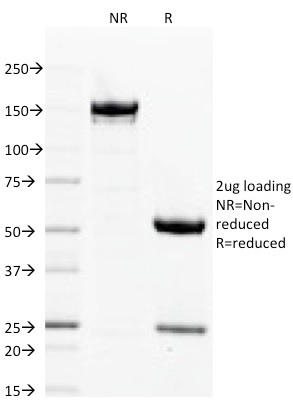 SDS-PAGE Analysis  Purified Filaggrin Mouse Monoclonal Antibody (FLG/1563).Confirmation of Integrity and Purity of Antibody.