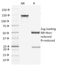 SDS-PAGE Analysis Purified Filaggrin Mouse Monoclonal Antibody (FLG/1945).Confirmation of Integrity and Purity of Antibody.