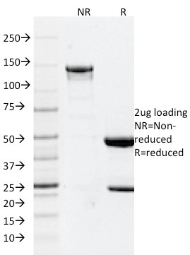 SDS-PAGE Analysis Purified GFAP Mouse Monoclonal Antibody (GFAP/2076).Confirmation of Integrity and Purity of Antibody.