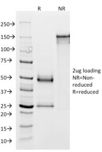 SDS-PAGE Analysis Purified GP2 Mouse Monoclonal Antibody (GP2/1803). Confirmation of Integrity and Purity of Antibody.