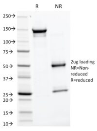 SDSPAGE Analysis  Purified GP2 Mouse Monoclonal Antibody (GP2/1805). Confirmation of Purity and Integrity.