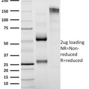 SDS-PAGE Analysis Purified Granzyme B Mouse Monoclonal Antibody (GZMB/2403).Confirmation of Integrity and Purity of Antibody.