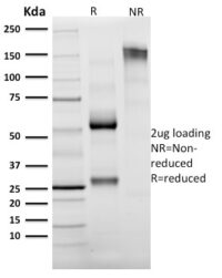 SDS-PAGE Analysis Purified Granzyme B Mouse Monoclonal Antibody (GZMB/2403).Confirmation of Integrity and Purity of Antibody.