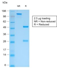 SDS-PAGE Analysis Purified IgG Mouse Recombinant Monoclonal Antibody (rIG266).Confirmation of Purity and Integrity of Antibody.