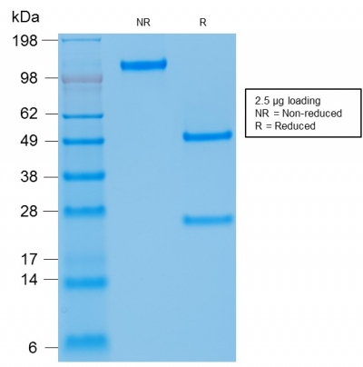 SDS-PAGE Analysis of Purified Kappa Light Chain Mouse Recombinant Monoclonal Ab (rKLC709).Confirmation of Purity and Integrity of Antibody.