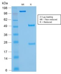 SDS-PAGE Analysis Kappa Light Chain Mouse Recombinant Monoclonal Antibody (rKLC264).Confirmation of Purity and Integrity of Antibody.