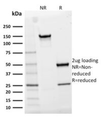 SDS-PAGE Analysis Purified CD25Mouse Monoclonal Antibody (IL2RA/2395).Confirmation of Integrity and Purity of Antibody