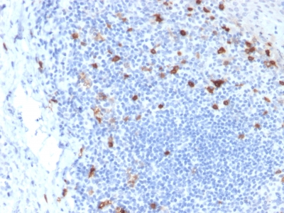Formalin-fixed, paraffin-embedded human Tonsil stained with CD103 Mouse Monoclonal Antibody (ITGAE/2063).