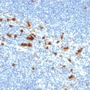 Formalin-fixed, paraffin-embedded human Tonsil stained with CD103 Mouse Monoclonal Antibody (ITGAE/2474).
