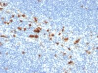 Formalin-fixed, paraffin-embedded human Tonsil stained with CD103 Mouse Monoclonal Antibody (ITGAE/2474).