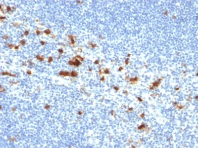 Formalin-fixed, paraffin-embedded human Tonsil stained with CD103 Mouse Monoclonal Antibody (ITGAE/2474).