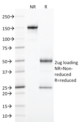 SDS-PAGE Analysis Purified CD103 Mouse Monoclonal Antibody (ITGAE/2474).Confirmation of Purity and Integrity of Antibody.