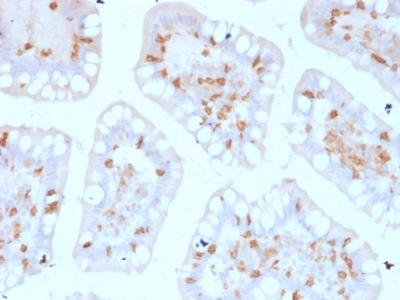Formalin-fixed, paraffin-embedded human Colon stained with CD103 Mouse Monoclonal Antibody (ITGAE/2474).