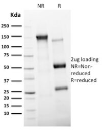 SDS-PAGE Analysis Purified CD11c Mouse Monoclonal Antibody (ITGAX/2507).Confirmation of Integrity and Purity of Antibody.