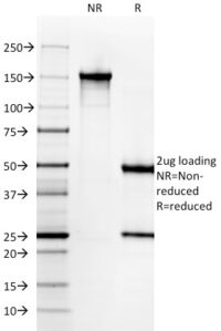 SDS-PAGE Analysis Purified Cytokeratin 6A (KRT6A) Mouse Monoclonal Antibody (KRT6A/2368). Confirmation of Integrity and Purity of Antibody