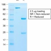 SDS-PAGE Analysis Purified Cytokeratin 10 Rabbit Recombinant MAb (KRT10/1990R).Confirmation of Purity and Integrity of Antibody.