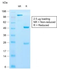 SDS-PAGE Analysis Purified Cytokeratin 10 Rabbit Recombinant MAb (KRT10/1990R).Confirmation of Purity and Integrity of Antibody.