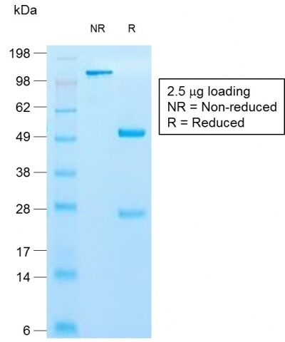 SDS-PAGE Analysis Purified Cytokeratin 10 Rabbit Recombinant MAb (KRT10/1990R).Confirmation of Purity and Integrity of Antibody.