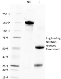 SDS-PAGE Analysis Purified TACSTD2 / TROP2 Mouse Monoclonal Antibody (TACSTD2/2151).Confirmation of Integrity and Purity of Antibody.