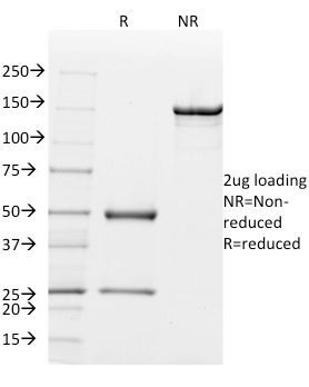 SDS-PAGE Analysis Purified Mouse Monoclonal Antibody (MGB1/2000) to Mammaglobin. Confirmation of Integrity and Purity of Antibody.