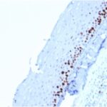 Formalin-fixed, paraffin-embedded human Tonsil-Skin stained with Ki67 Mouse Monoclonal Antibody (MKI67/2462).