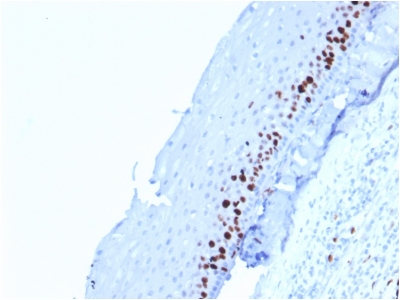 Formalin-fixed, paraffin-embedded human Tonsil-Skin stained with Ki67 Mouse Monoclonal Antibody (MKI67/2462).