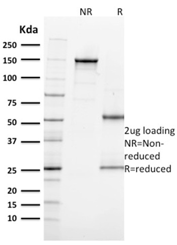 SDS-PAGE Analysis Purified Ki67 Mouse Monoclonal Antibody (MKI67/2462).Confirmation of Integrity and Purity of Antibody