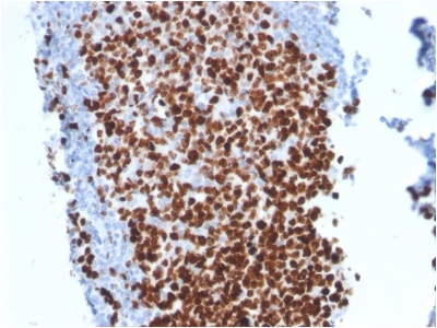 Formalin-fixed, paraffin-embedded human Tonsil stained with Ki67 Mouse Monoclonal Antibody (MKI67/2462).