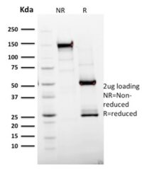 SDS-PAGE Analysis Purified Ki67 Mouse Monoclonal Antibody (MKI67/2465).Confirmation of Integrity and Purity of Antibody.