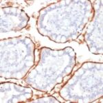 Formalin-fixed, paraffin-embedded Human Colon stained with CD10 Mouse Monoclonal Antibody (MME/1870).