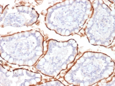 Formalin-fixed, paraffin-embedded Human Colon stained with CD10 Mouse Monoclonal Antibody (MME/1870).