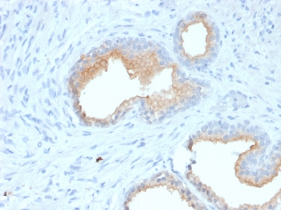 Formalin-fixed, paraffin-embedded Human Prostate stained with CD10 Mouse Monoclonal Antibody (MME/1870).