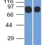 Western Blot (1) Raji and (2) Ramos Cell lysates using CD10 Mouse Monoclonal Antibody (MME/1892).