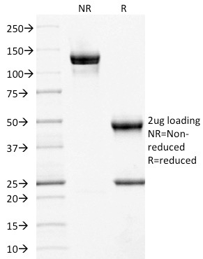 SDS-PAGE Analysis Purified CD10 Mouse Monoclonal Antibody (MME/1892).Confirmation of Purity and Integrity of Antibody.