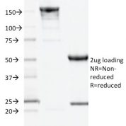 SDS-PAGE Analysis Purified CD10 Mouse Monoclonal Antibody (MME/1893).Confirmation of Integrity and Purity of Antibody.