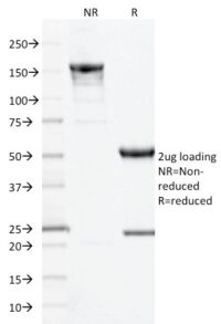 SDS-PAGE Analysis Purified CD10 Mouse Monoclonal Antibody (MME/1893).Confirmation of Integrity and Purity of Antibody.