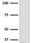 Western Blot Analysis of human A431 cell lysate using MTAP Mouse Monoclonal Antibody (MTAP/1813).