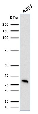 Western Blot Analysis of human A431 cell lysate using MTAP Mouse Monoclonal Antibody (MTAP/1813).