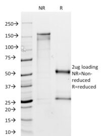 SDS-PAGE Analysis Purified MTAP Mouse Monoclonal Antibody (MTAP/1813).Confirmation of Integrity and Purity of Antibody.